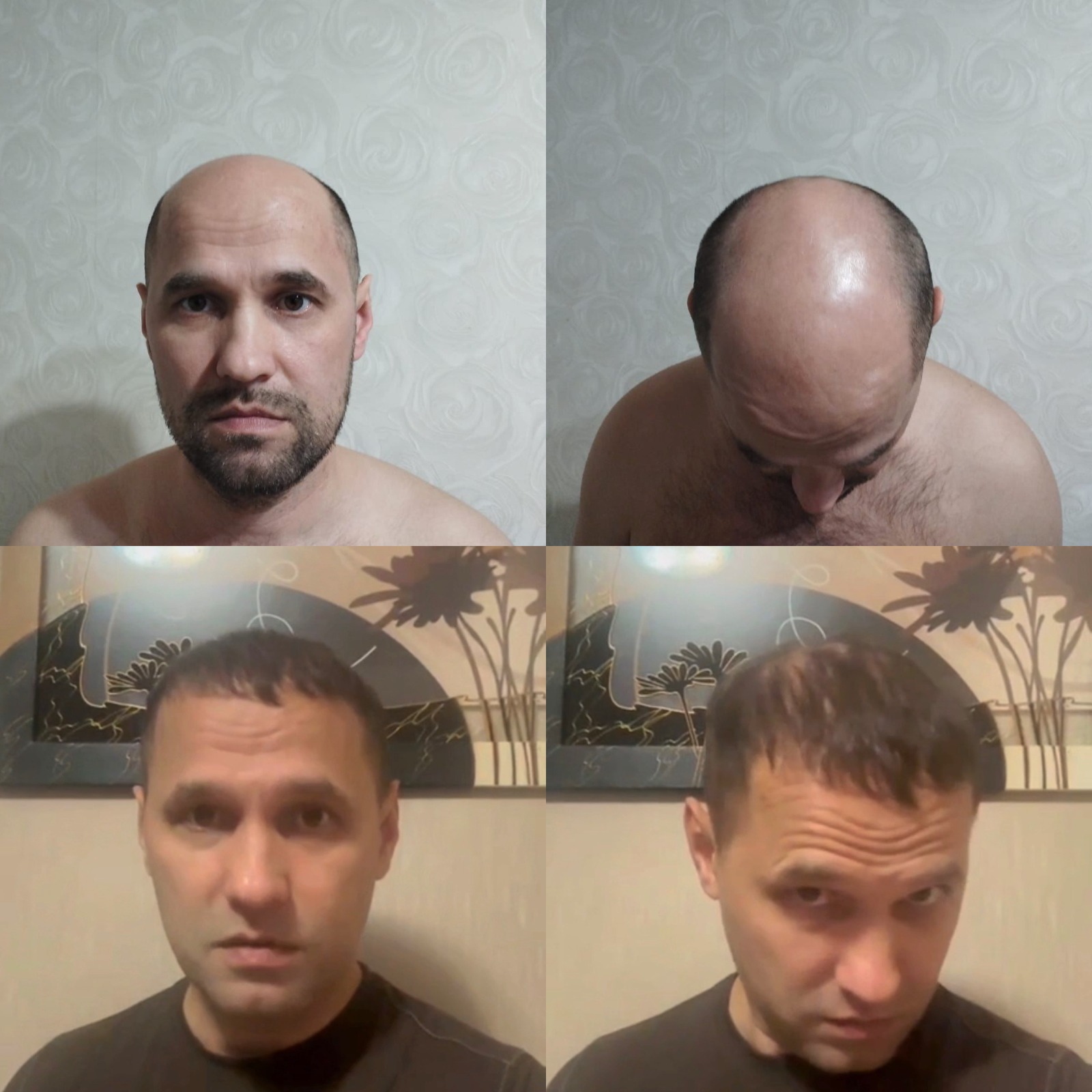 История пациента — результат